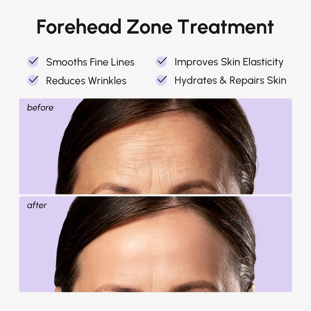 Forehead Smoothing Patches